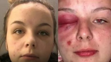 Foto de Jovem que se agrediu com martelo para forjar agressão é condenada por falsas acusações de estupro