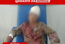 Foto de Vítima de feminicídio foi espancada por companheiro: este é segundo caso registrado em SAJ em 2023