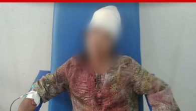 Foto de Vítima de feminicídio foi espancada por companheiro: este é segundo caso registrado em SAJ em 2023